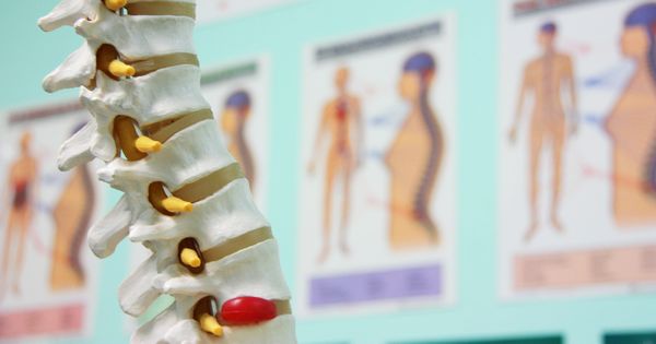Rückenschmerzen können viele Ursachen haben. Wenn du auch unter unerklärlichen Schmerzen leidest, solltest du diese Ursachen prüfen und gegensteuern.