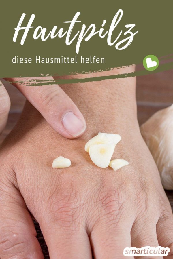 Hautpilz mit Hausmitteln behandeln - an Brust, Rücken, Hals und im Gesicht