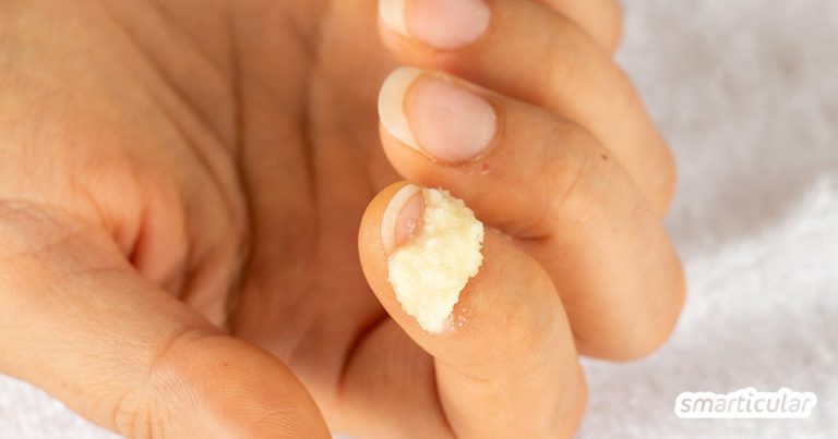Nagelbettentzündung: Diese Hausmittel helfen