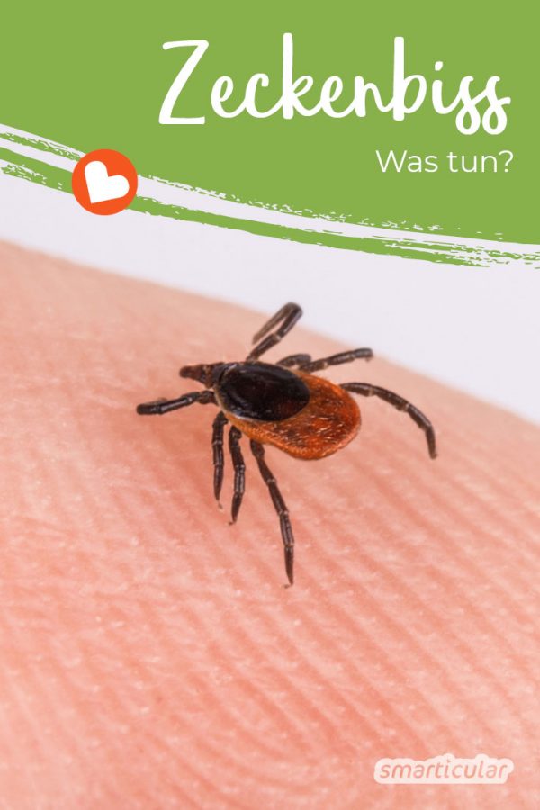 Was tun bei Zeckenbiss? Erste Hilfe bei Zeckenstich