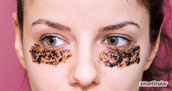Augenringe wegbekommen: Anstatt teure kosmetische Produkte einzusetzen, kann man auch einfache Hausmittel gegen Augenringe verwenden.