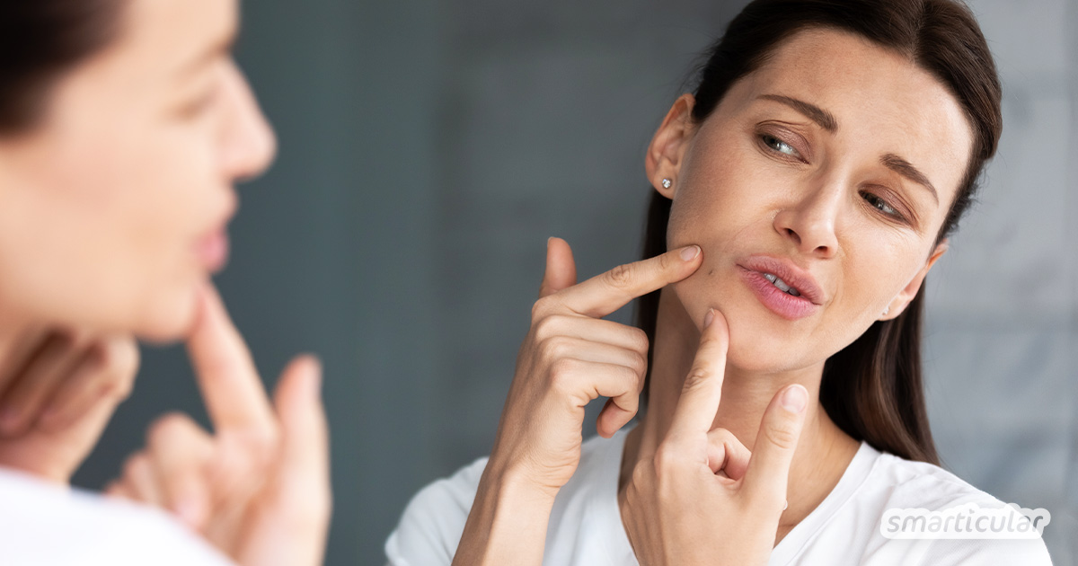 Was hilft gegen verstopfte Poren im Gesicht? Hier erfährst du, wie du mit einfachen Mitteln und auf sanfte Weise Mitesser entfernen kannst.